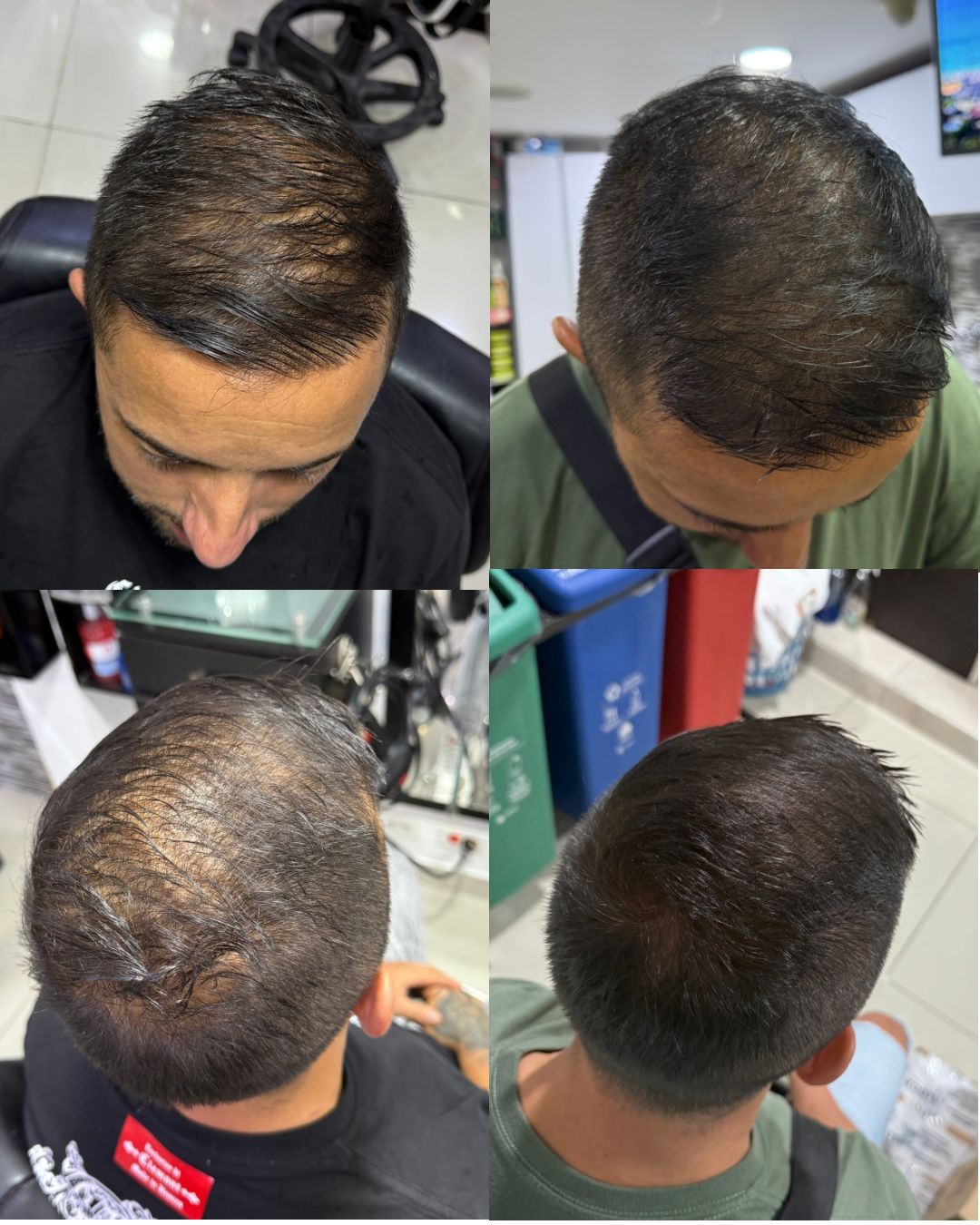 Shampoo Revital Men
