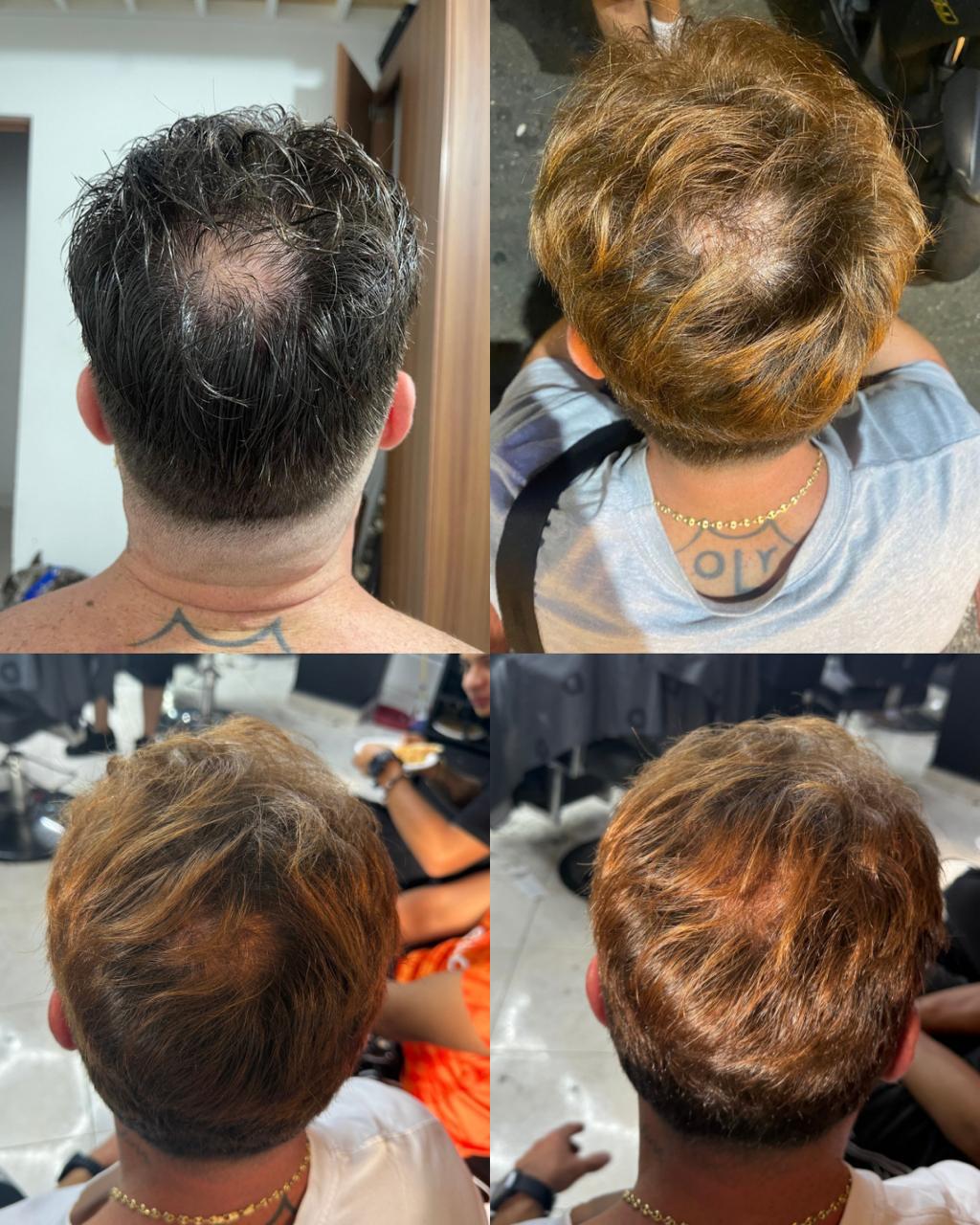Combo Shampoo Revital + Tonico Abundia Capilar